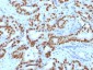Anti-FOXA1 / HNF3A Antibody